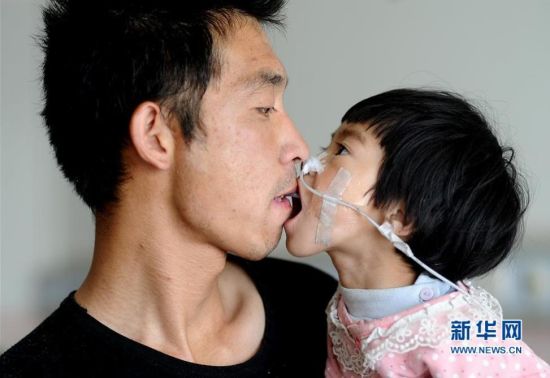 患病女兒無法進(jìn)食 父親嘴對嘴喂食女兒