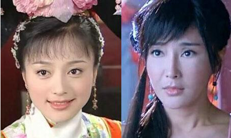 秦嵐整容前后對(duì)比照片