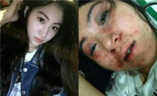 女歌手拒陪酒遭暴打3小時(shí)