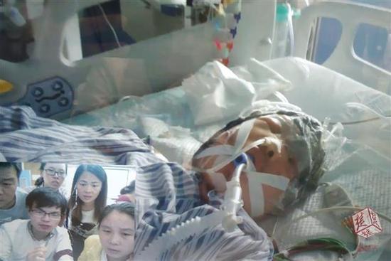 農(nóng)婦頭發(fā)卷收割機 還未脫離生命危險